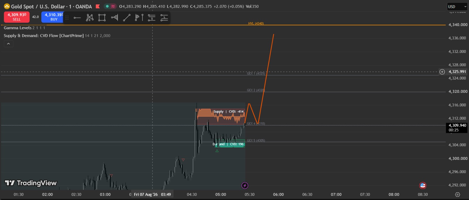 XAU/USD 1M